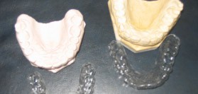 PLACAS NEUROMIORELAJANTES Y/O DE BRUXISMO